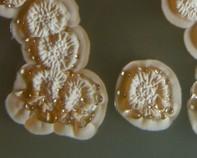streptomyces streptomyces colony
